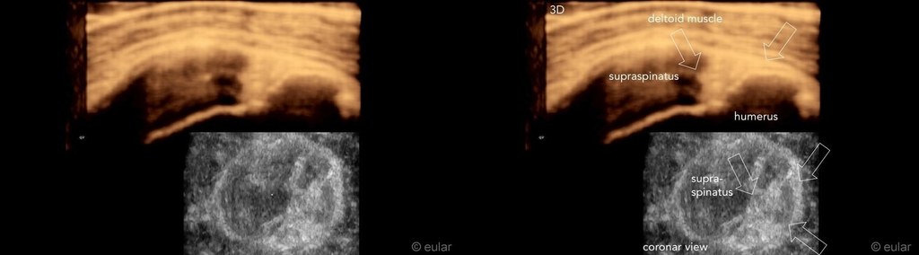 Course: Eular Imaging Library